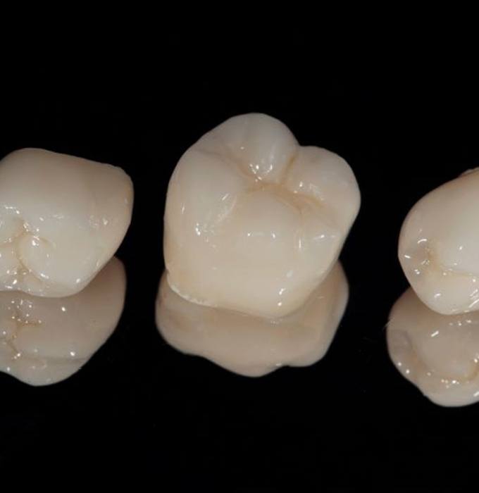 Three dental crowns on reflective surface