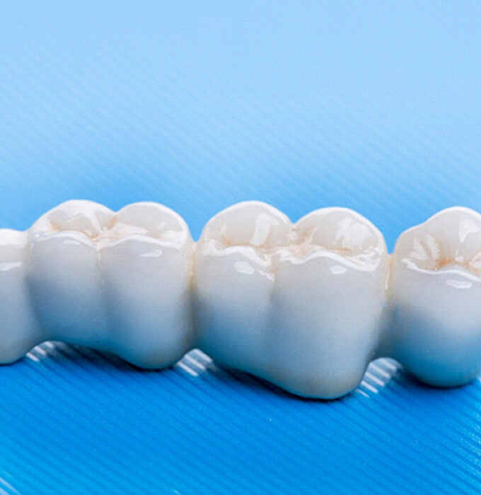 A dental bridge set against a blue background