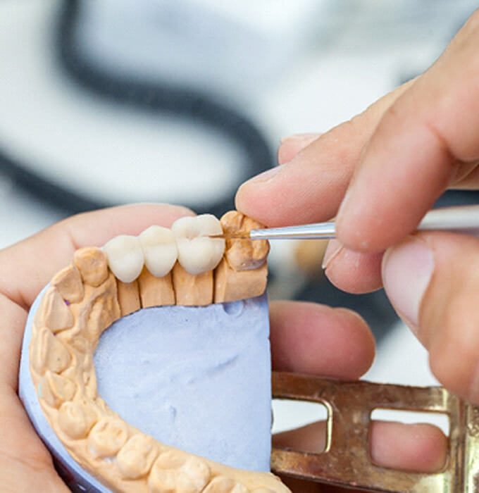 A technician working on a dental bridge