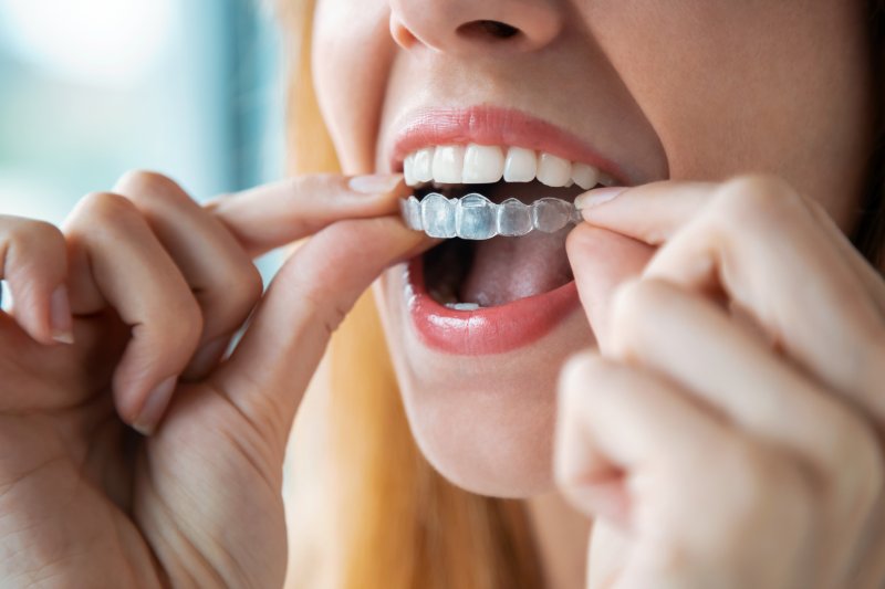 young woman putting on an Invisalign aligner